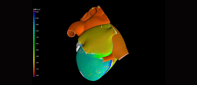 心臓模型の肉厚解析