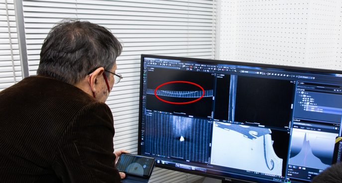 半月状に補修された表板の断面図