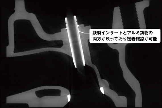 ミリフォーカスCT